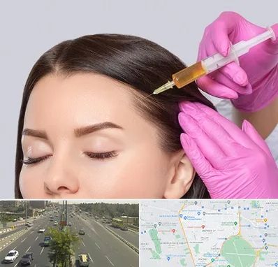 تزریق هیر فیلر در منطقه 17 تهران 