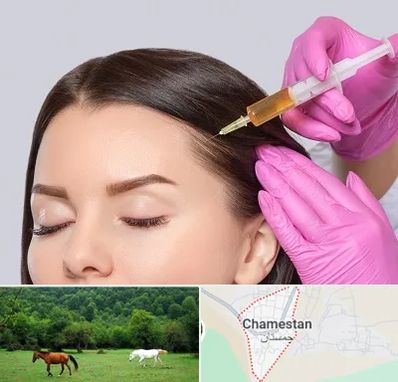 تزریق هیر فیلر در چمستان