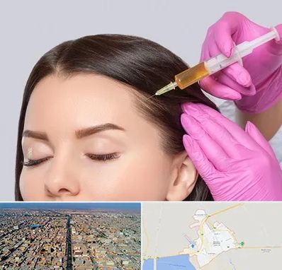 تزریق هیر فیلر در بندر ماهشهر