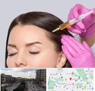 تزریق هیر فیلر در بلوار فردوسی مشهد