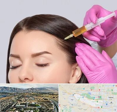 تزریق هیر فیلر در منطقه 21 تهران 
