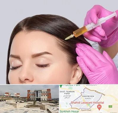 تزریق هیر فیلر در حکیمیه 