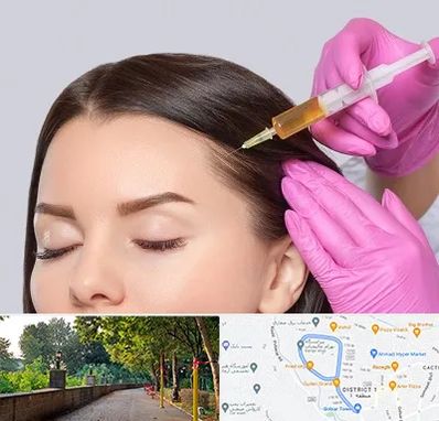 تزریق هیر فیلر در فلکه گاز رشت