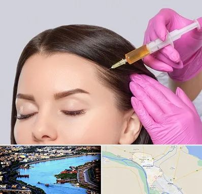 تزریق هیر فیلر در خرمشهر