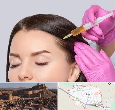 تزریق هیر فیلر در بم