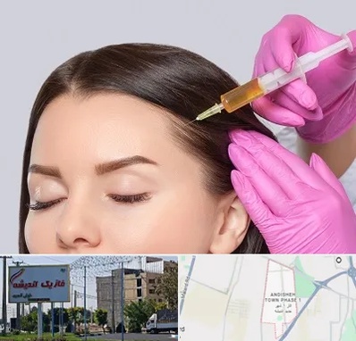 تزریق هیر فیلر در فاز یک اندیشه