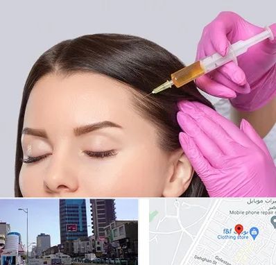 تزریق هیر فیلر در چهارراه طالقانی کرج