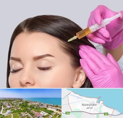 تزریق هیر فیلر در نوشهر