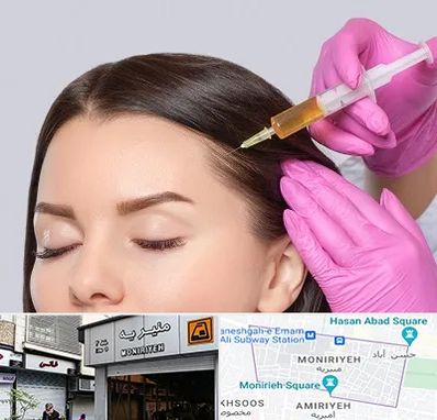 تزریق هیر فیلر در منیریه 