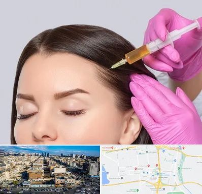 تزریق هیر فیلر در شهرک راه آهن