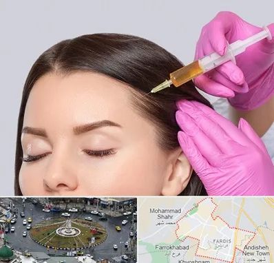 تزریق هیر فیلر در فردیس کرج 