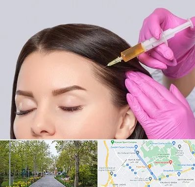 تزریق هیر فیلر در قدوسی غربی شیراز