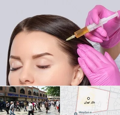 تزریق هیر فیلر در بازار تهران