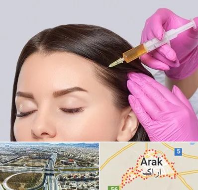 تزریق هیر فیلر در اراک