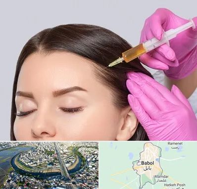 تزریق هیر فیلر در بابل