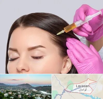 تزریق هیر فیلر در لواسان