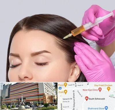 تزریق هیر فیلر در سهروردی 