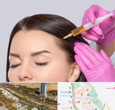 تزریق هیر فیلر در خیابان نیایش شیراز