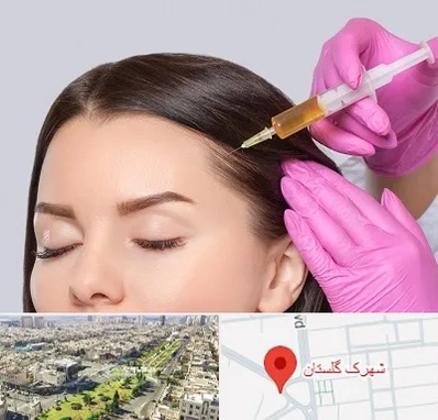 تزریق هیر فیلر در شهرک گلستان