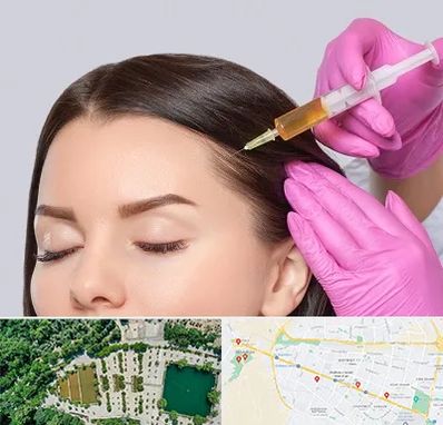 تزریق هیر فیلر در وکیل آباد مشهد