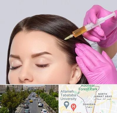 تزریق هیر فیلر در شهران 