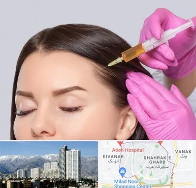 تزریق هیر فیلر در شهرک غرب 