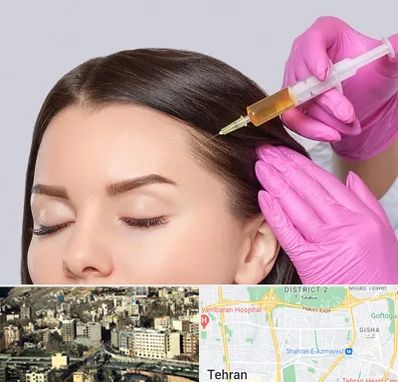 تزریق هیر فیلر در مرزداران 