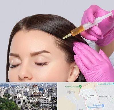 تزریق هیر فیلر در ولنجک 