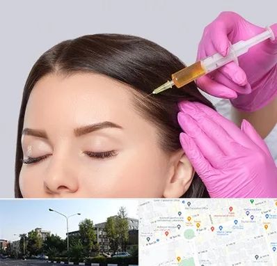 تزریق هیر فیلر در میدان کاج 