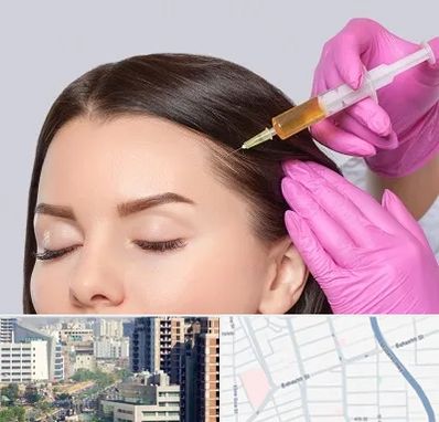 تزریق هیر فیلر در خیابان بهشتی