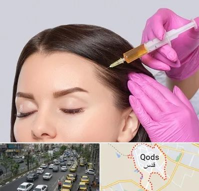 تزریق هیر فیلر در شهر قدس