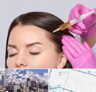 تزریق هیر فیلر در ازگل