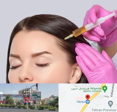 تزریق هیر فیلر در هروی 