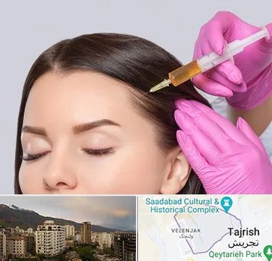 تزریق هیر فیلر در زعفرانیه 