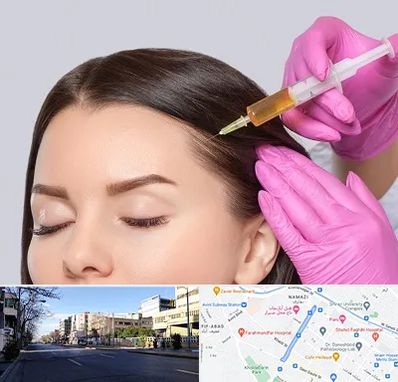 تزریق هیر فیلر در خیابان ملاصدرا شیراز