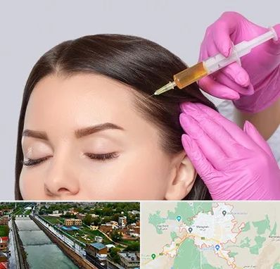 تزریق هیر فیلر در مراغه