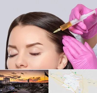 تزریق هیر فیلر در قوچان