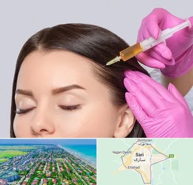 تزریق هیر فیلر در ساری