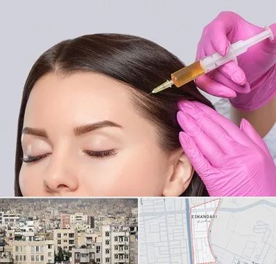 تزریق هیر فیلر در اسکندری