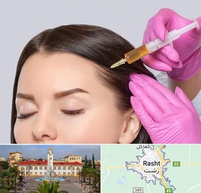 تزریق هیر فیلر در رشت