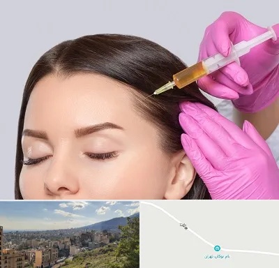 تزریق هیر فیلر در بوکان تهران