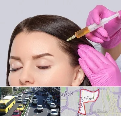 تزریق هیر فیلر در امیرآباد