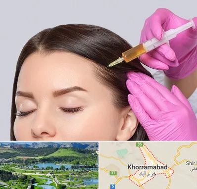 تزریق هیر فیلر در خرم آباد