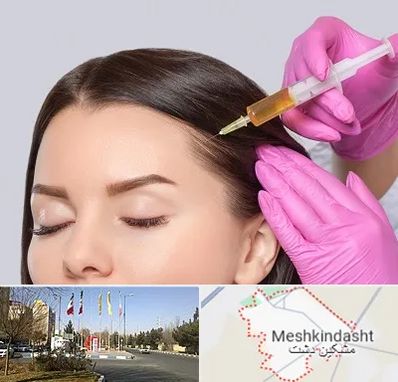 تزریق هیر فیلر در مشکین دشت