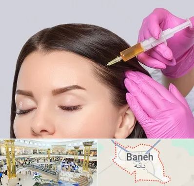 تزریق هیر فیلر در بانه