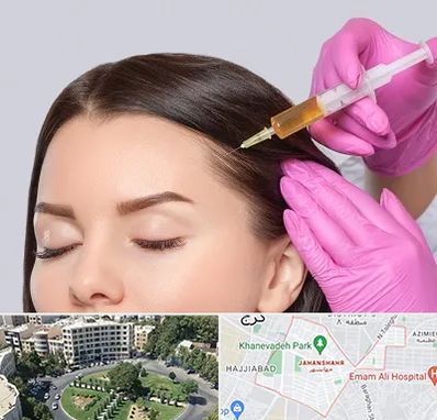 تزریق هیر فیلر در جهانشهر کرج 