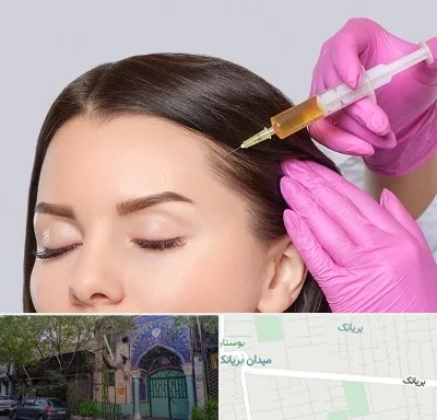 تزریق هیر فیلر در بریانک