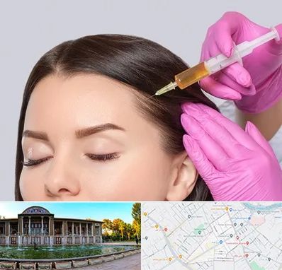 تزریق هیر فیلر در عفیف آباد شیراز