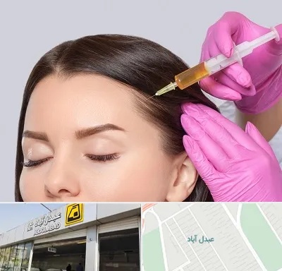 تزریق هیر فیلر در عبدل آباد