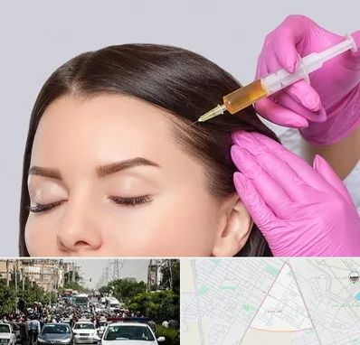 تزریق هیر فیلر در سیدی مشهد